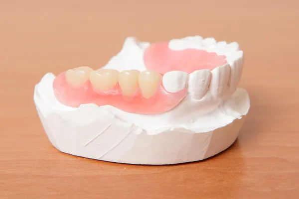 Dentadura acrílica (Dentes falsos ) — Fotografia de Stock