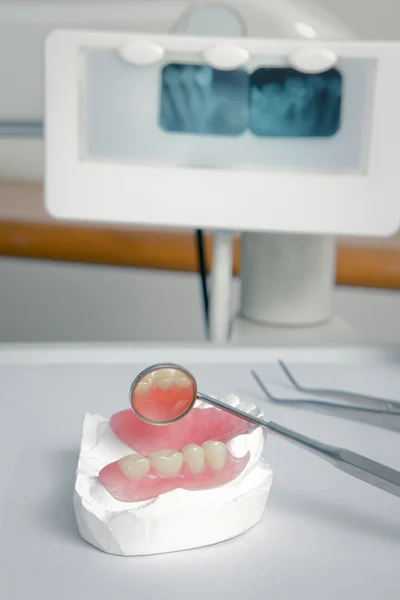 Ferramentas odontológicas com prótese acrílica (Dentes falsos ) — Fotografia de Stock