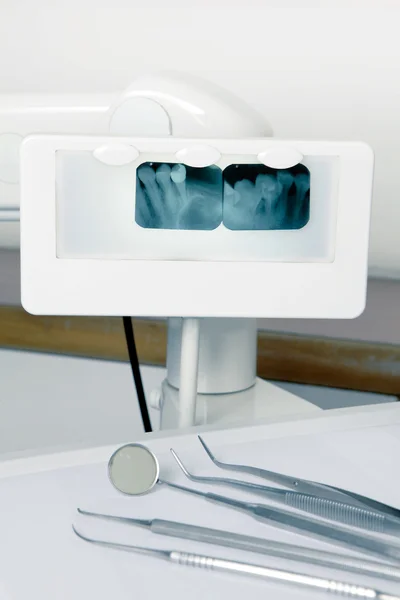Röntgenbild der Zähne — Stockfoto