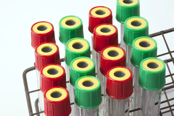 Blood tubes — Stock Photo, Image