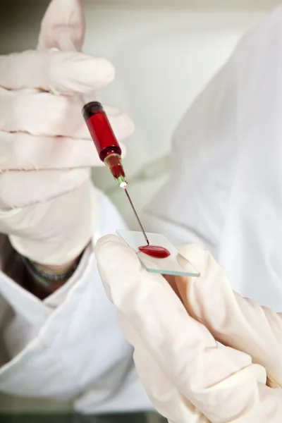 Blood and tests — Stock Photo, Image