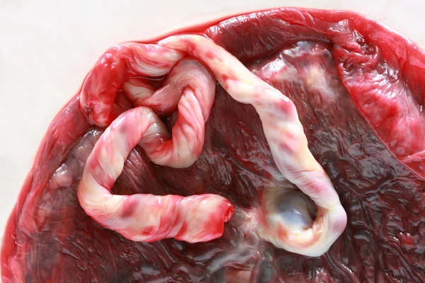 Färska placenta hos människa — Stockfoto