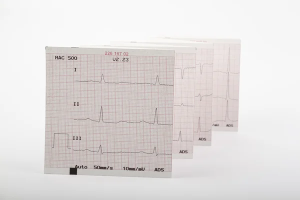 stock image Cardiogram