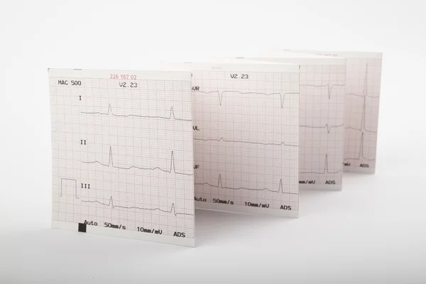 stock image Cardiogram