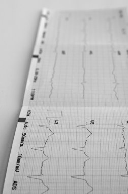 cardiograma, gráfico de ecg