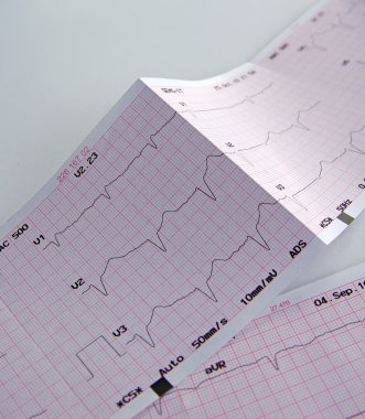 cardiograma, gráfico de ecg