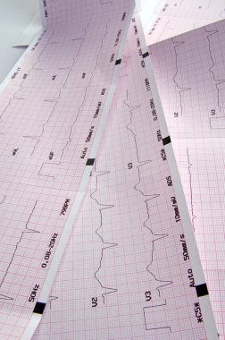 cardiograma, gráfico de ecg