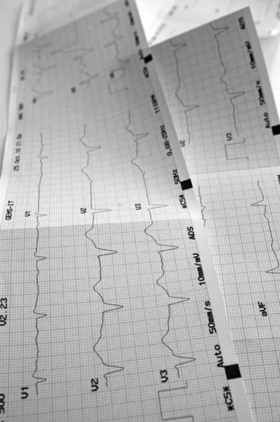 Cardiograma, gráfico de ECG — Fotografia de Stock