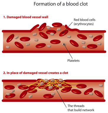 Blood clots clipart