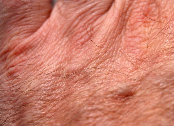 Человеческая кожа — стоковое фото