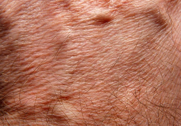 Human skin — Stock Photo, Image