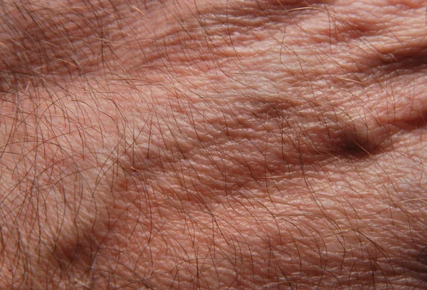 Menselijke huid — Stockfoto