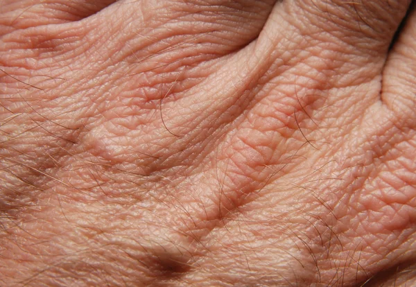 인간의 피부 — 스톡 사진