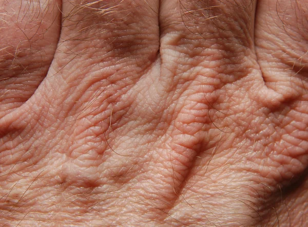 Menselijke huid — Stockfoto