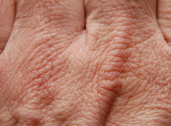ヒトの皮膚 — ストック写真