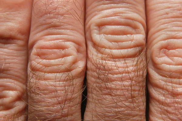 Ανθρώπινο δέρμα — Φωτογραφία Αρχείου