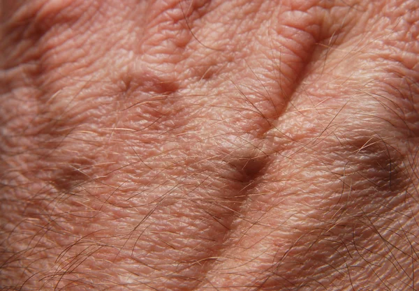 Lidská kůže — Stock fotografie