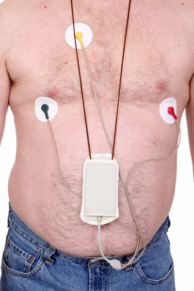 Elektrokardiogram — Zdjęcie stockowe