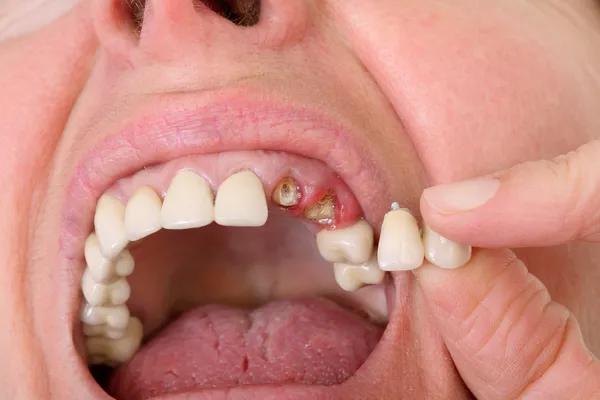Zubní — Stock fotografie