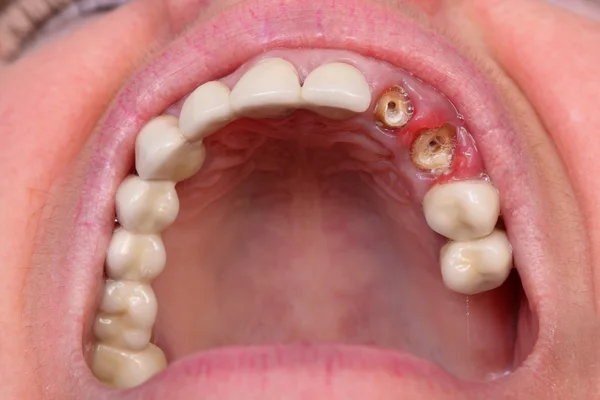 Dentale — Foto Stock