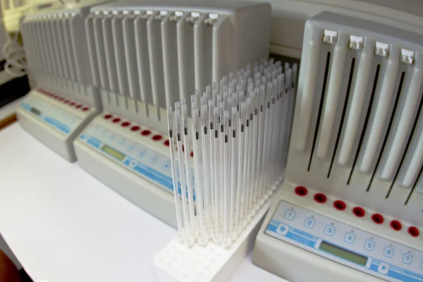 혈액 검사 기계 — 스톡 사진