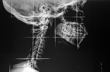 Radiography of the cervical spine and jaw clipart
