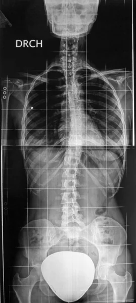 Radiografia tył — Zdjęcie stockowe