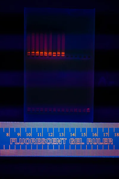Электрофореграмма разделения ДНК — стоковое фото