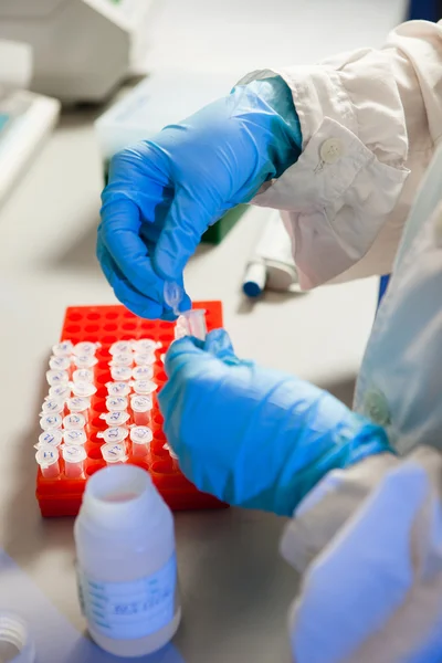 Preparación de muestras biológicas — Foto de Stock