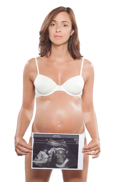 Escaneamento ultrassonográfico da mulher grávida — Fotografia de Stock