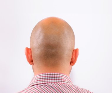 Baldness clipart