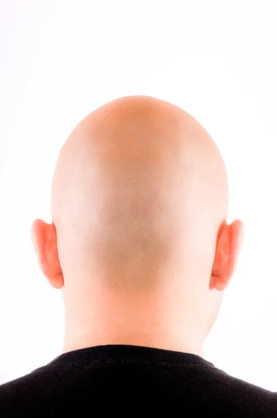 Shaved hair — Stock Photo, Image