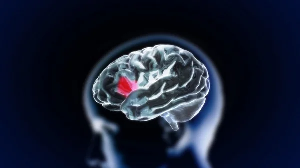 O cérebro de cristal part2 — Fotografia de Stock