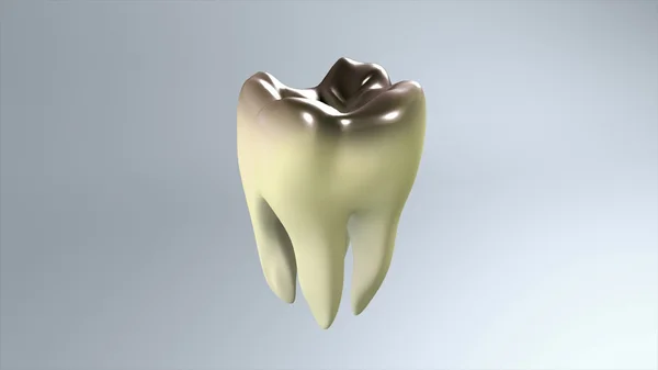 Mau dente fundo branco — Fotografia de Stock