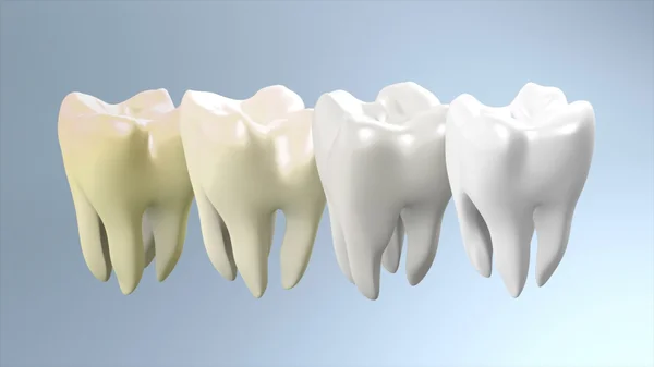 Étape de la dent pour être processus blanc — Photo