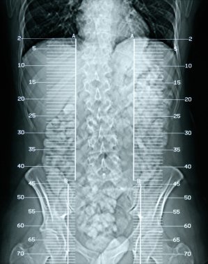 X-ray anatomy clipart
