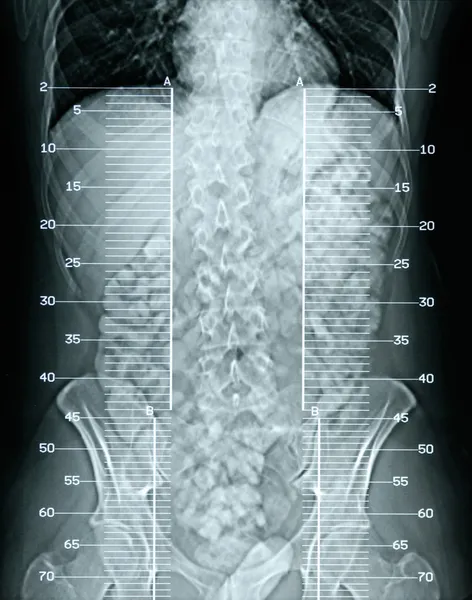 stock image X-ray anatomy