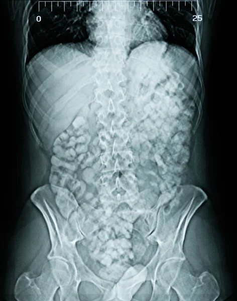 stock image X-ray anatomy