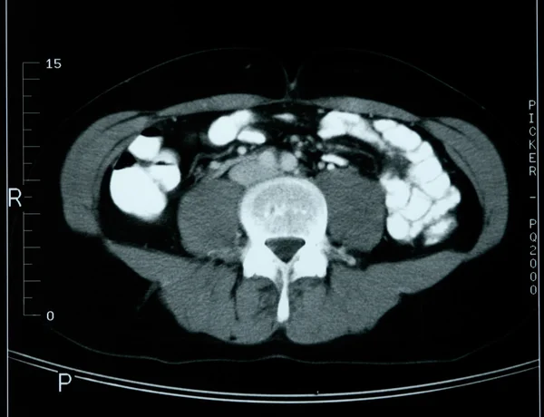 stock image X-ray anatomy