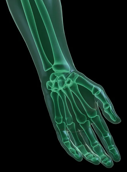 Hand X-Ray on black — Stock Photo, Image