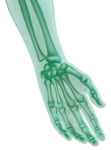 Hand x-ray op wit — Stockfoto