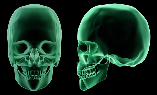 Estrutura esquelética de raios-X da cabeça humana — Fotografia de Stock