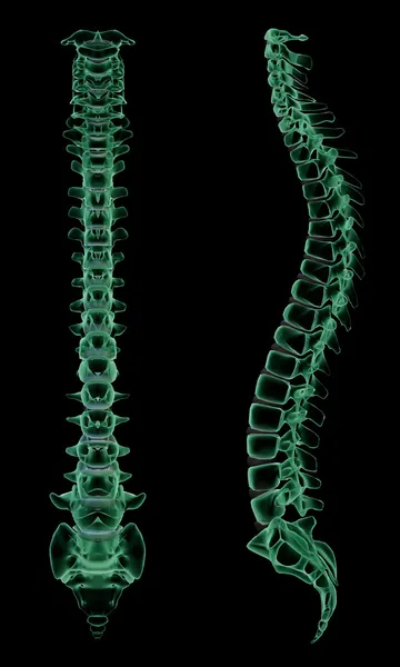 X 射线的人体脊柱骨骼结构 — 图库照片