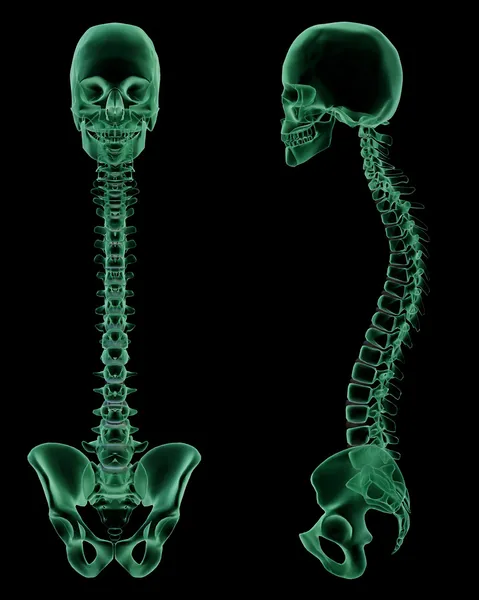 X-ray skelet van de menselijke wervelkolom, wervelkolom en bekkengordel — Stockfoto