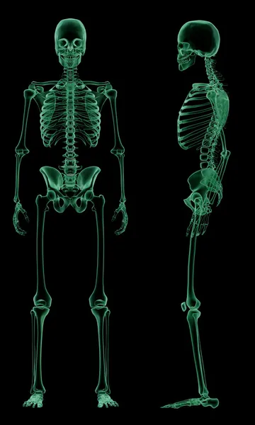 X-ray skelet van de menselijke arm — Stockfoto