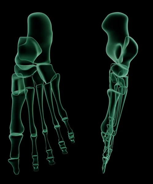 Estrutura esquelética de raios X do Pé Humano — Fotografia de Stock