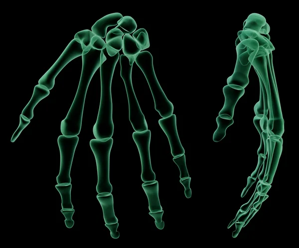 Röntgen skelett struktur i den mänskliga handen — Stockfoto