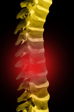Spinal-column clipart