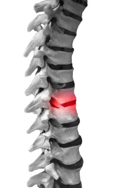 Human Spinal-column model clipart