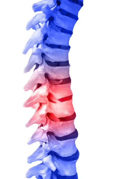 脊柱脊髓 — 图库照片